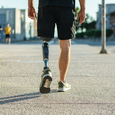 62a83c7086f88f844e71a3eb_Can you walk normally with a prosthetic leg